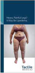 lipedema-pt-bro